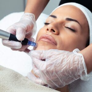 dermapen-facial-scaled